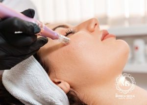 Microneedling